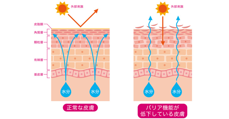 乾燥肌が慢性化する原因